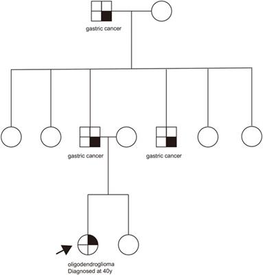 The First Case Report of a Patient With Oligodendroglioma Harboring CHEK2 Germline Mutation